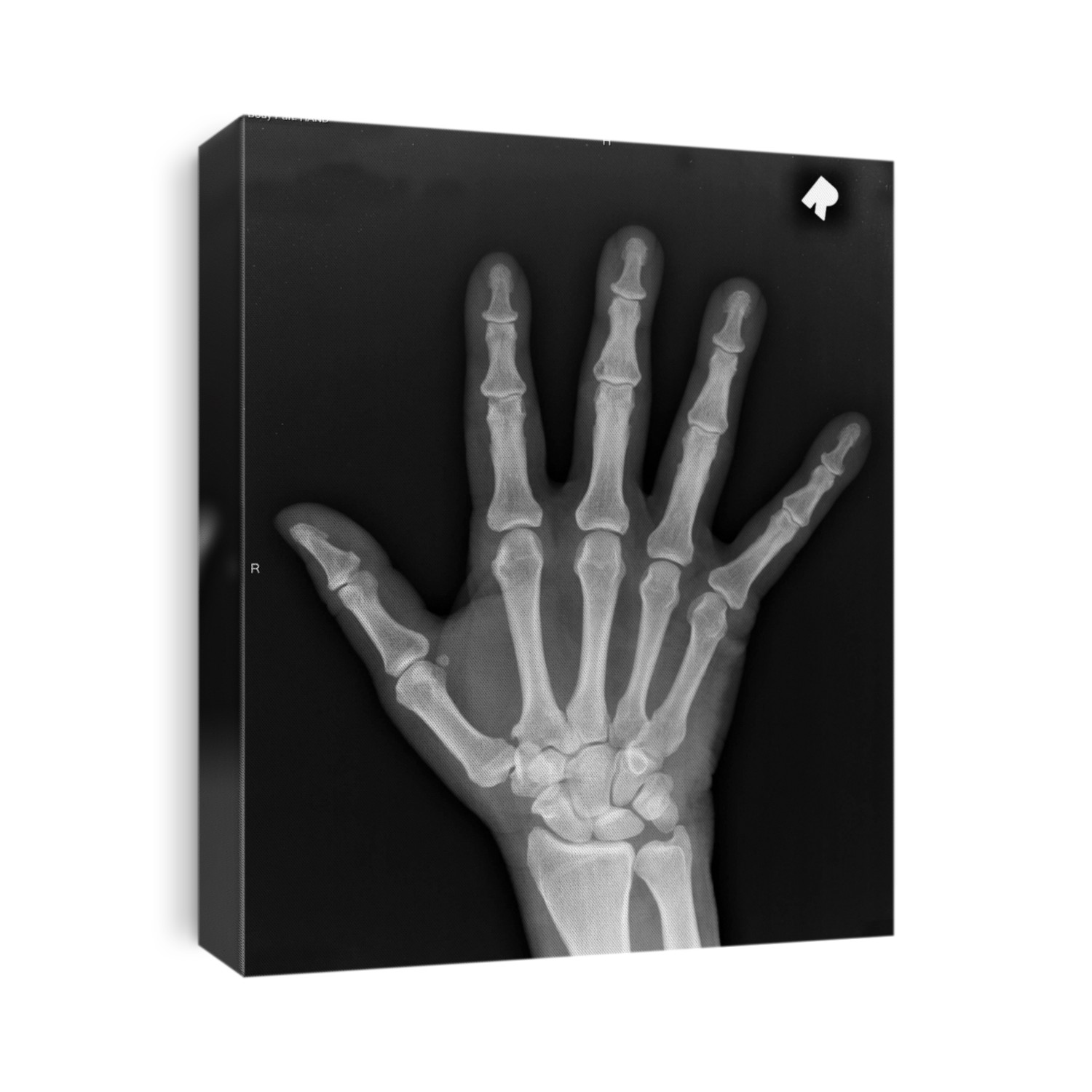 X-Ray Image Of Human Hand. Human Hand X-Ray isolated on black. 